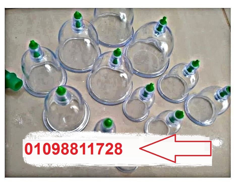 حجامة إسلامية طبية - لامتصاص السموم