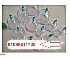 حجامة إسلامية طبية - لامتصاص السموم - 1